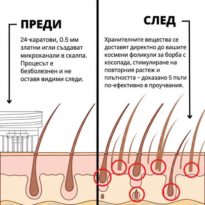 NOXRA Hair Rergrowth Therapy                        Професионална терапия за растеж и укрепване на косата